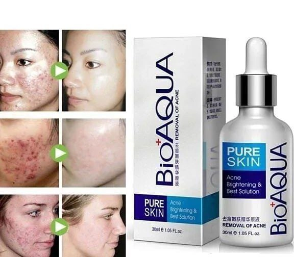 سرم درمانی ضد جوش و آکنه صورت بیوآکوا