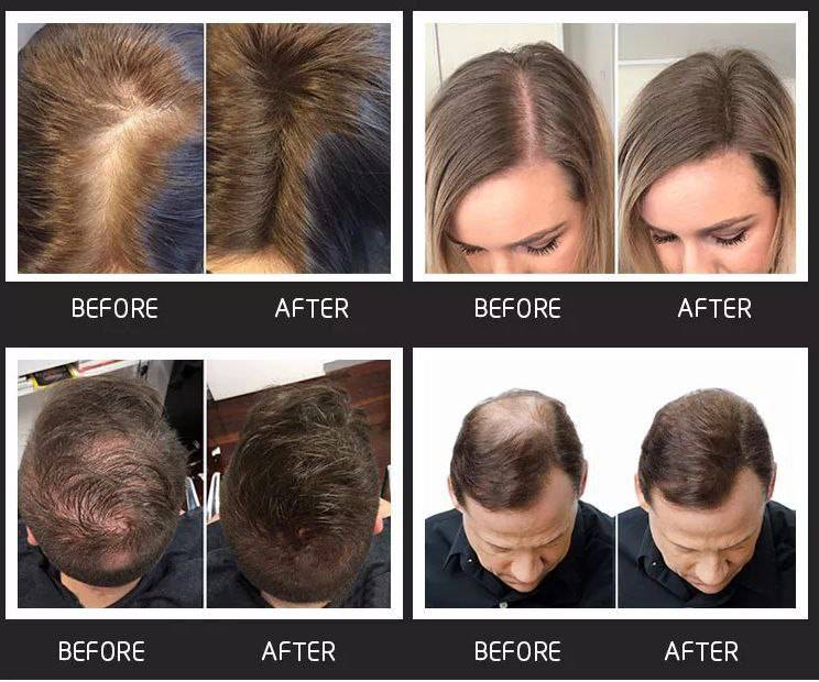 پودر پر پشت کننده مو تاپیک مارک دیسار